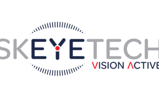 skeyetech vision active